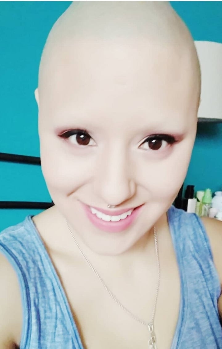 Baldscarmich