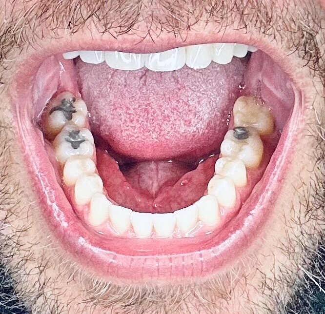 Bigolefeet14