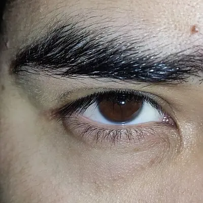 Elculodemex
