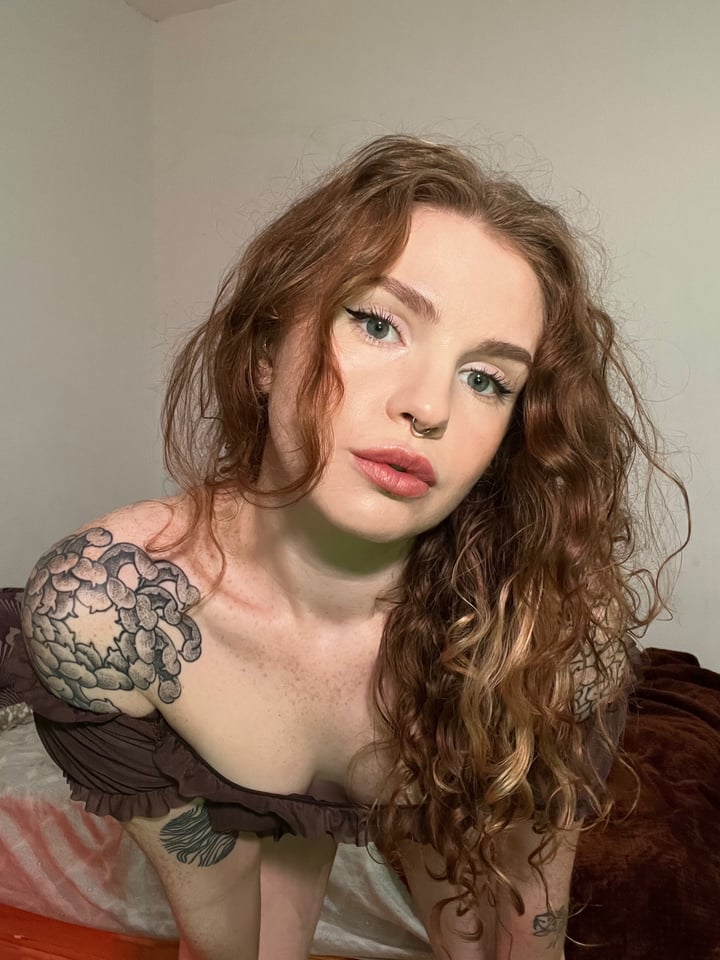 Frecklefox