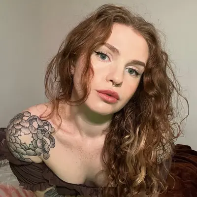 Frecklefox