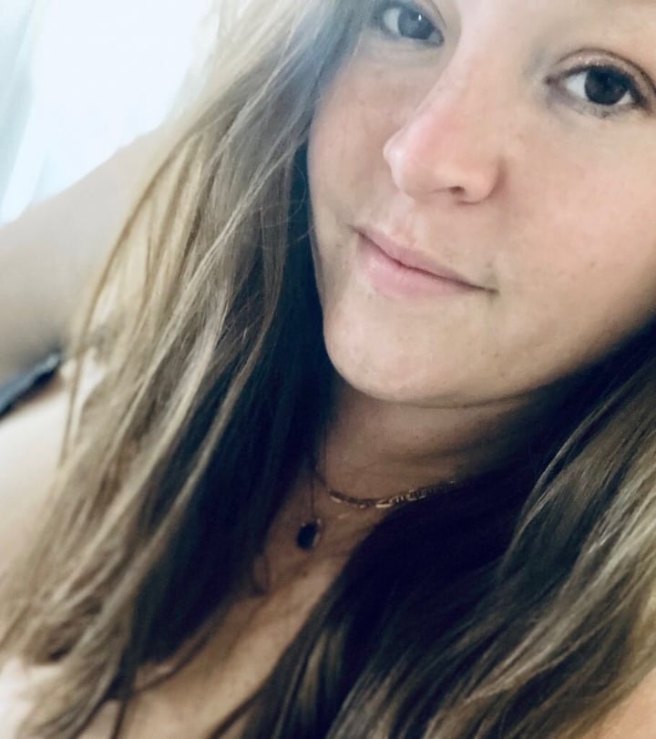 Freckles34