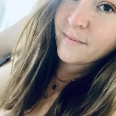 Freckles34