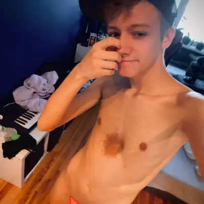 Albert