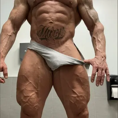 Maximusgluteus
