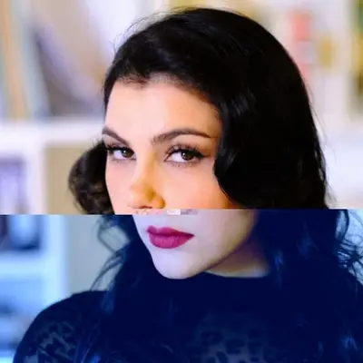 Noppvnappi