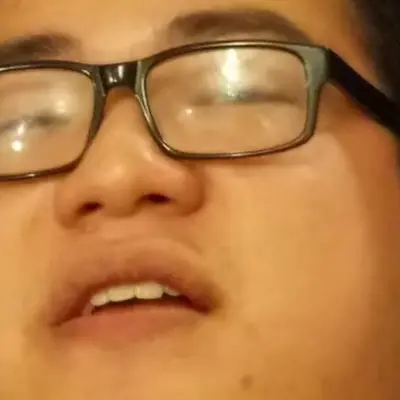 scarra