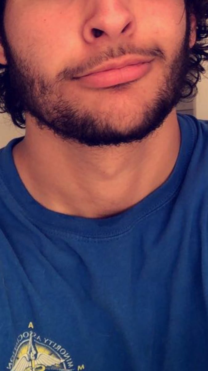 Tremendocomepinga