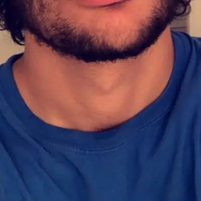 Tremendocomepinga