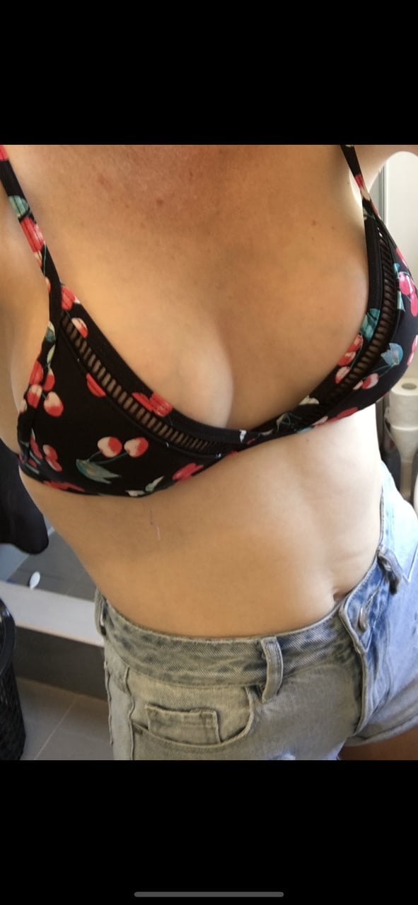 U51047420