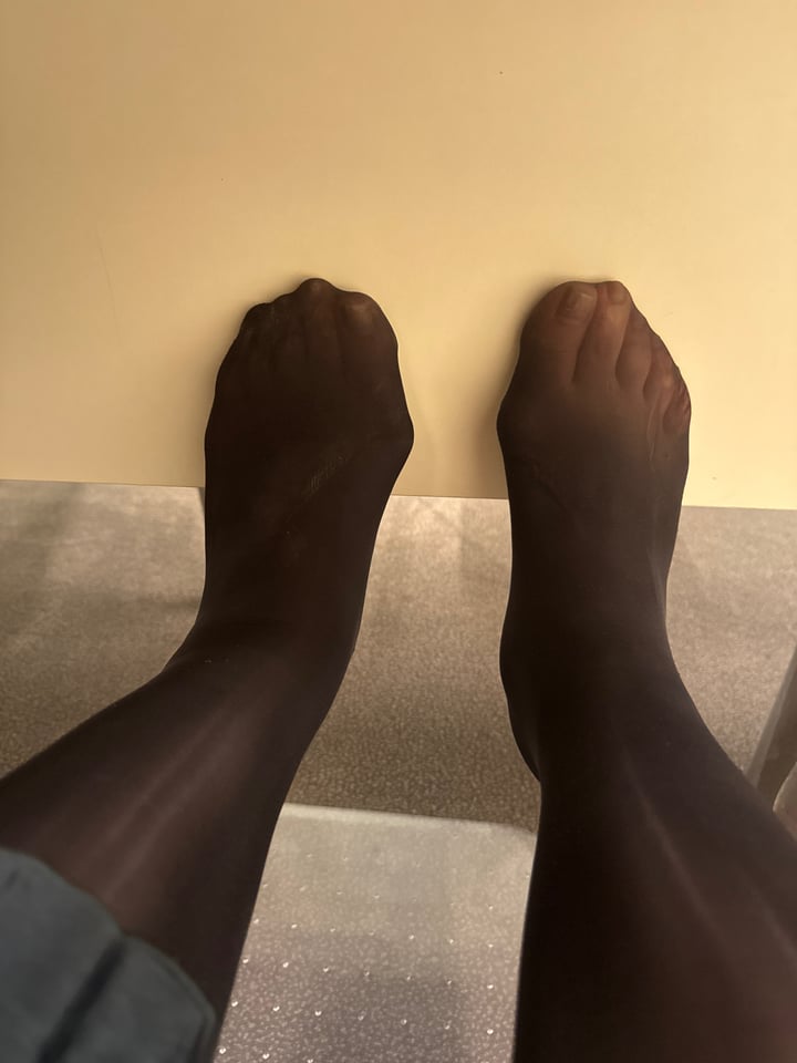 Ugly Chinese feet