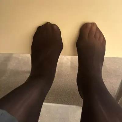 Ugly Chinese feet